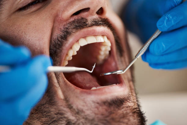 Best Emergency TMJ Treatment in Lead, SD